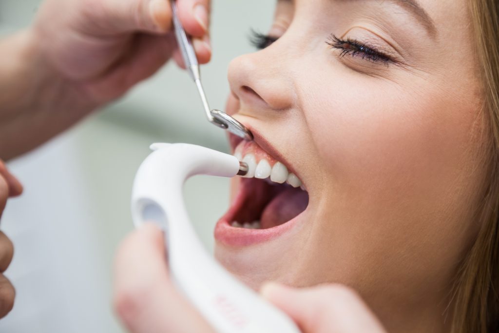 dentiste blanchiment Plateau-Mont-Royal